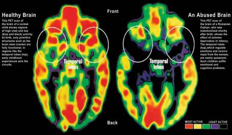 Brain activity scan